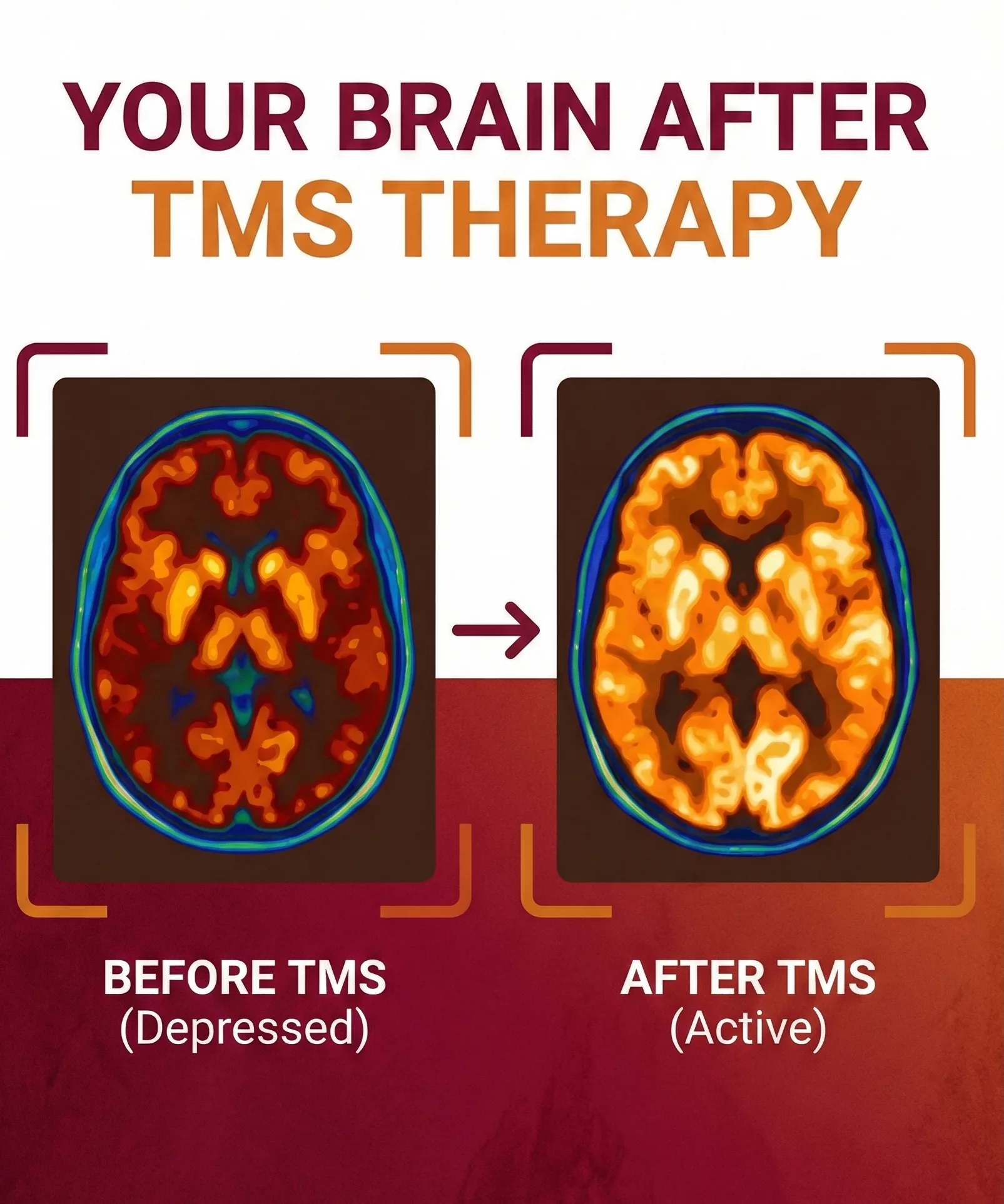 TMS Therapy — Before & After Ad